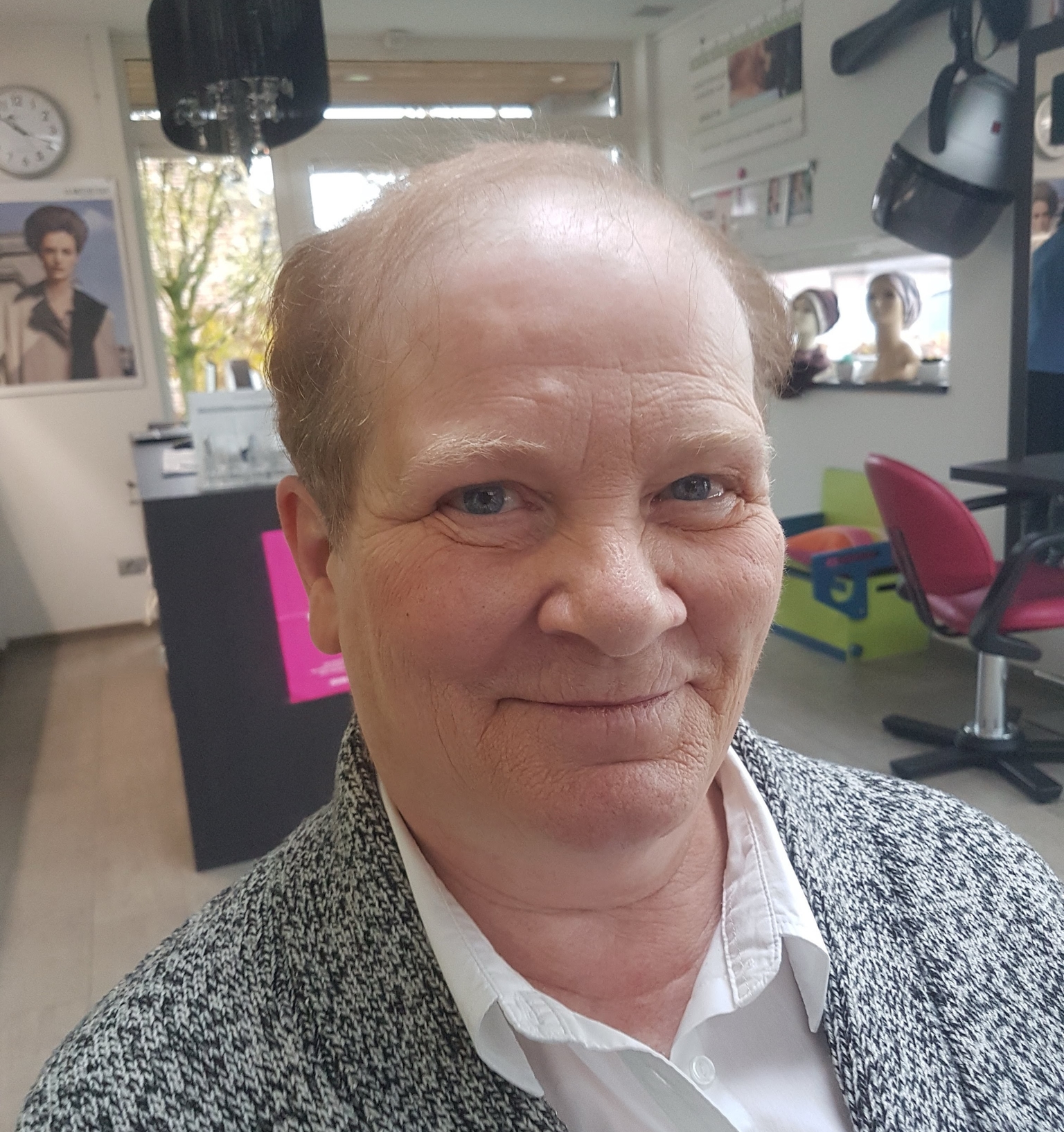 Zonder haarwerk.