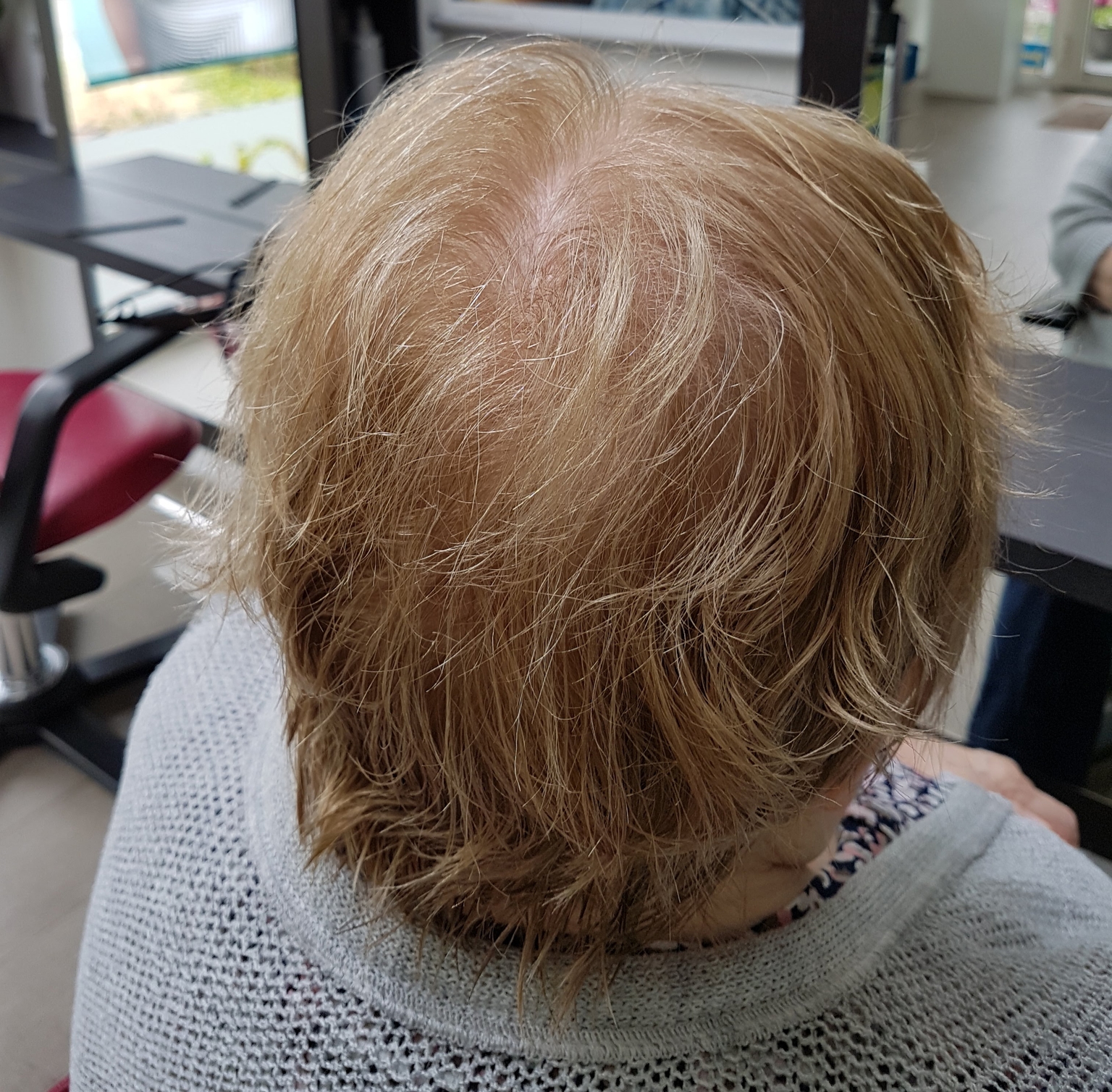 Zonder haarwerk.